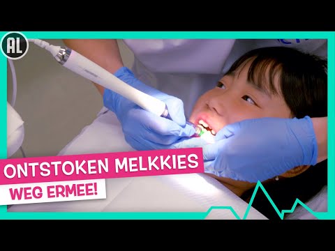ONTSTOKEN MELKKIES TREKKEN 🦷 - TOPDOKS