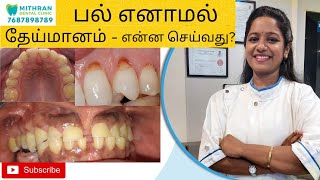 பல்  எனாமல் தேய்மானம்- என்ன செய்வது?Tooth Enamel Loss Ways to Fix It |Mithran Dental|DrJayalakshmi