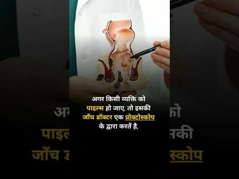 How is piles Tested?(पाइल्स का टेस्ट कैसे होता है?) #hemorrhoidspiles  #hemorrhoidscure #hemorrhoids