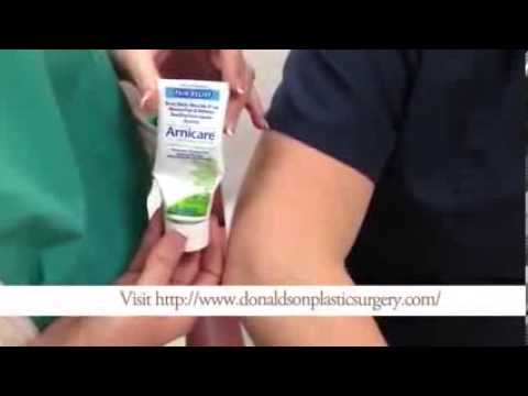 How To Apply Arnica Gel to Bruises and Swelling