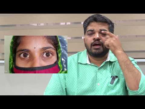 Droopy eyelid correction thumbnail