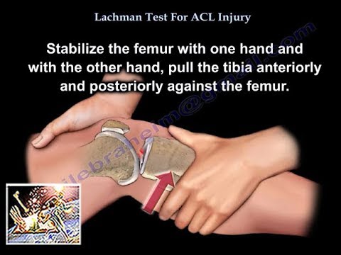 Lachman Test ACL Injury - Everything You Need To Know - Dr. Nabil Ebraheim - YouTube