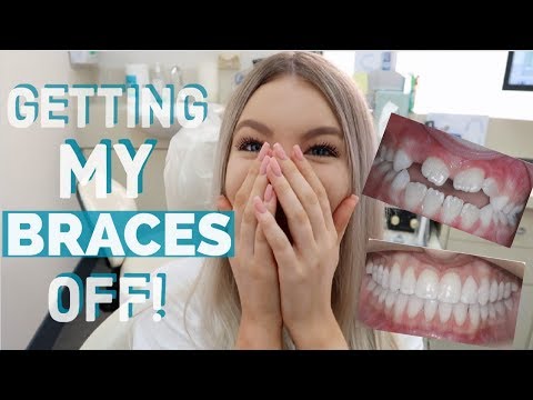 download lagu mp3 mp4 Getting Braces Off, download mp3 Getting Braces Off free download, download mp3 Getting Braces Off