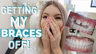 GETTING MY BRACES OFF!