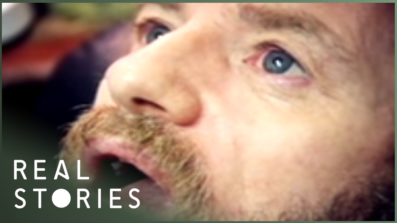 Amnesia and Me (Medical Documentary) | Real Stories