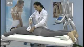 LPG Endermologie treatment demo - Salon House - London