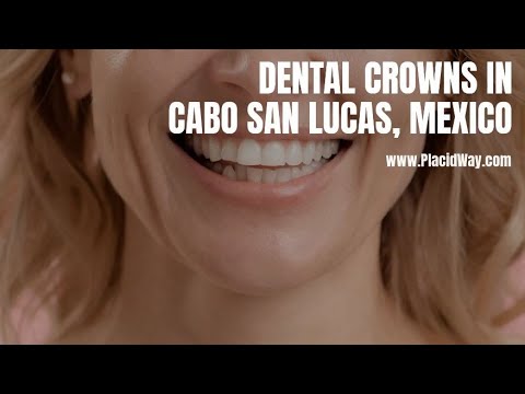 Dental Crowns in Cabo San Lucas, Mexico