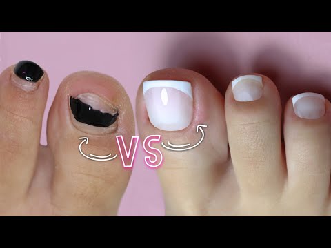FRENCH PEDICURE - comment réparer 𝟙 ongle cassé ou fissuré  🤓