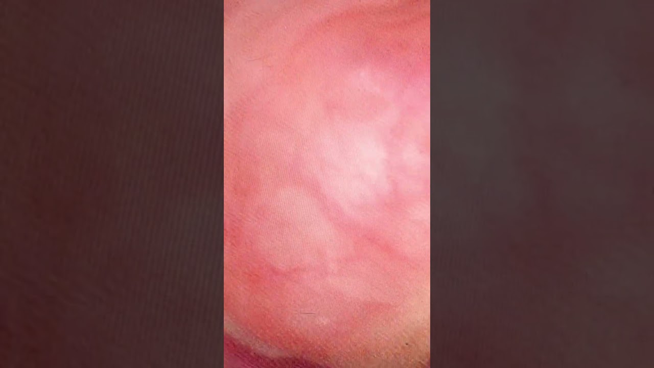 Juan Ramón Hernandez-14