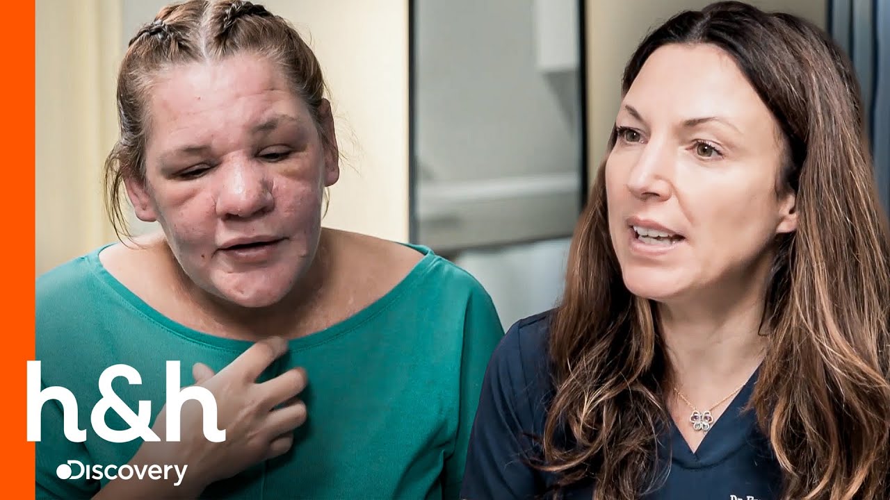 Paciente fica com o rosto inchado inesperadamente | Dra. Emma: Uma Questão de Pele | H&H Brasil