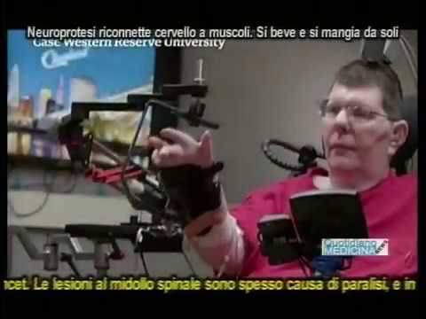 Siccome è corretto per fare il latte con aglio da vermi Rimedi di gente per disposizione di parassiti della persona