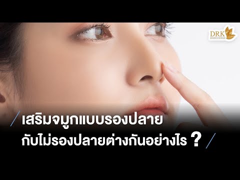 เมโสแฟต ยี่ห้อไหนดี