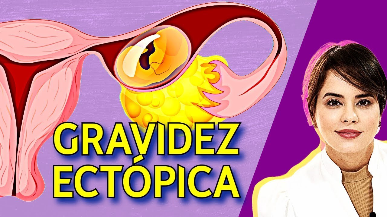 Alerta na Gravidez: Entenda o Perigo Silencioso da Gravidez Ectópica!