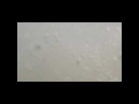 Shark attack in buxton n.c.