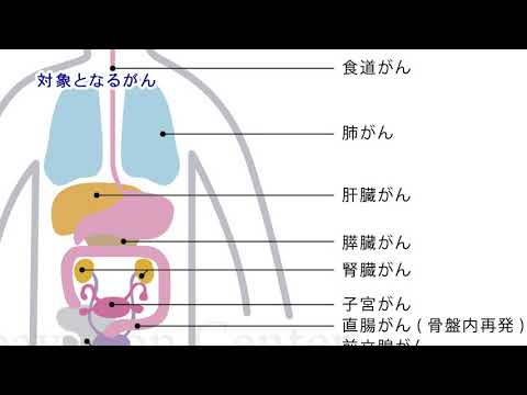 【山形大学】医学部東日本重粒子センター 05 対象となるがん