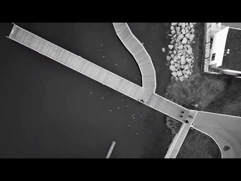 Spalla dolore articolare durante labbassamento del braccio Rotazione circolare del gomito