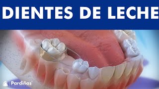 Los dientes de leche y el uso de mantenedores de espacio © - Clínica Dental Pardiñas