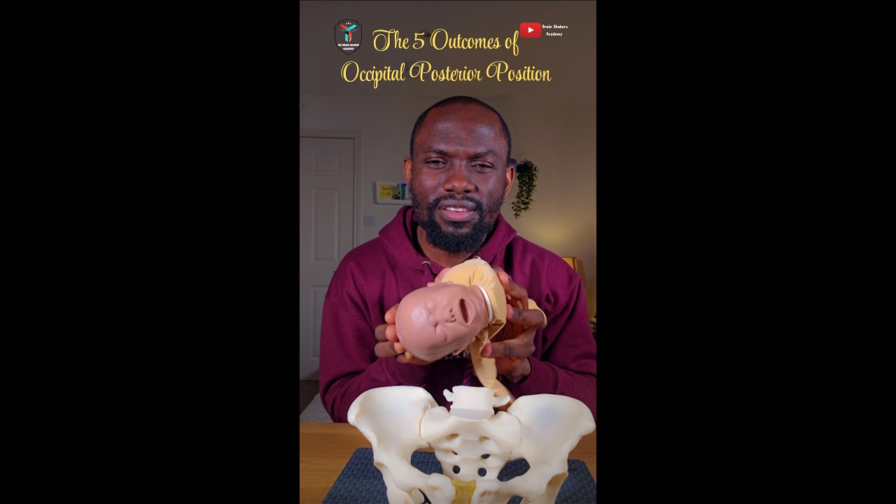 The 5 Outcomes of Occipital Posterior Position OPP - Back to Back Labour