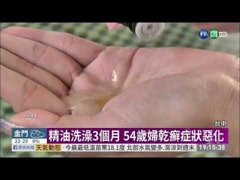 精油洗澡3個月 54歲婦乾癬症狀惡化