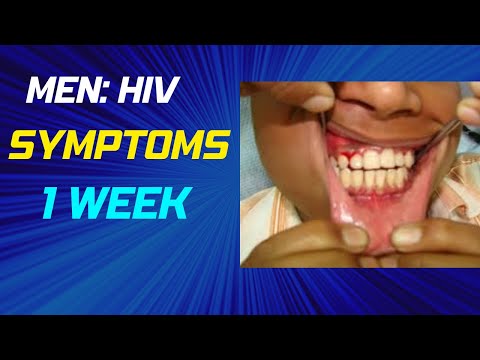 HIV symptoms in men after: 1 week