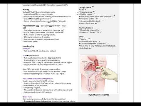 Prostate cancer gleason score 7 43