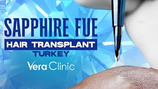 Sapphire FUE Hair Transplant Turkey #hairtransplant #sapphirefue #sapp