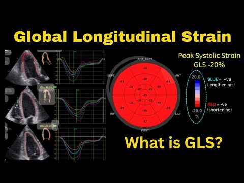 Global Longitudinal Strain | What is GLS?
