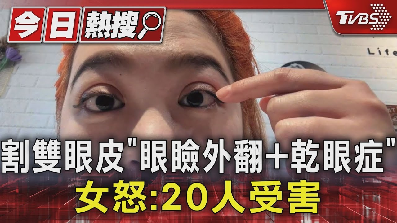 割雙眼皮「眼瞼外翻+乾眼症」 女怒:20人受害