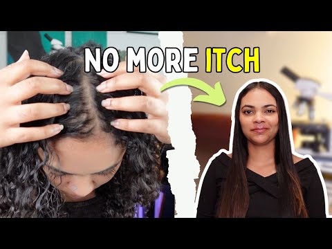 I Stopped Hiding My Dandruff and Started Styling Anyway