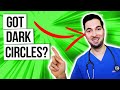 How To Get Rid Of Dark Circles Under Eyes And Home Remedy