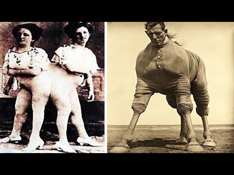 10 Circus Freaks That Actually Existed!