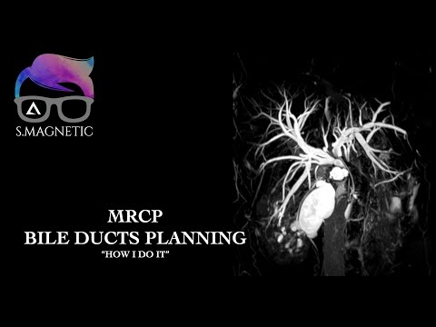 MRCP BILE DUCTS PLANNING. "HOW I DO IT"