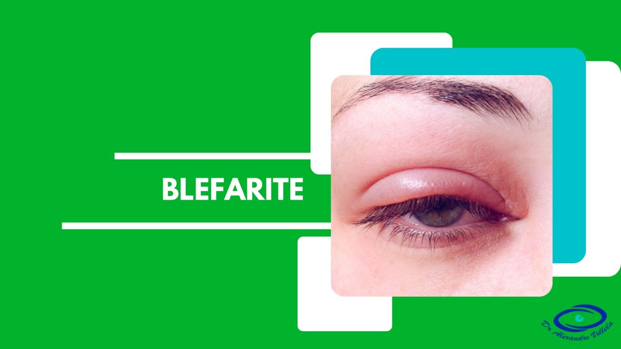 Alexandre Nogueira Villela Salgado-17