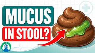 Mucus in Stool | Causes, Symptoms, and Treatment