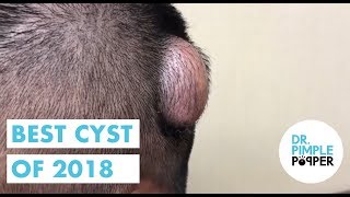 Best of Cysts Part One, 2018