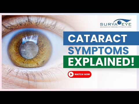 Cataract: Causes, Symptoms & Treatment | Dr. Jay Goyal | Surya Eye Institute