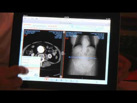 New Features for Carestream's Vue Motion Image Viewer