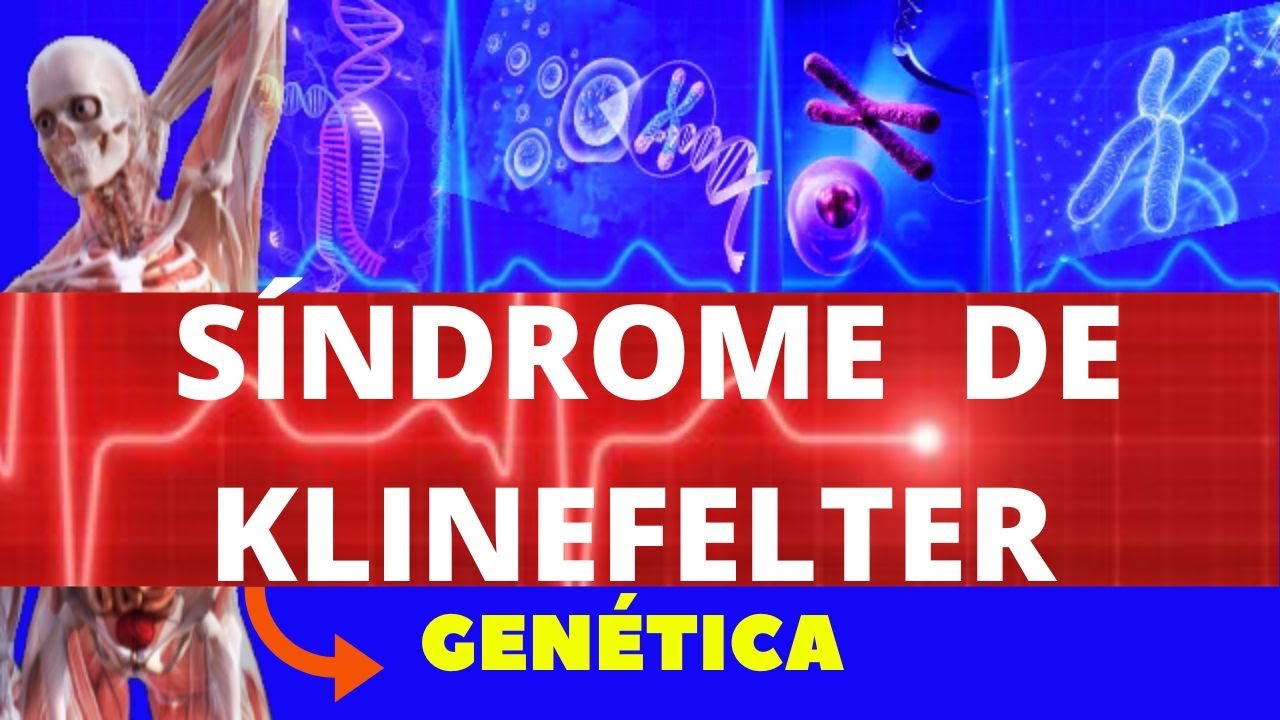 SÍNDROME DE KLINEFELTER - (O QUE É, CAUSAS, CARACTERÍSTICAS, DIAGNOSTICO E TRATAMENTO) GENÉTICA