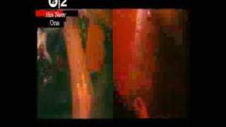 Amusement Parks On Fire - Blackout