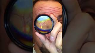 How to Do Your Own Fundus Exam