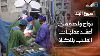 نجاح واحدة من أعقد عمليات القلب بالمكلا ومطارق الحدادين في الضالع تواجه الاندثار | أسبوع البلد