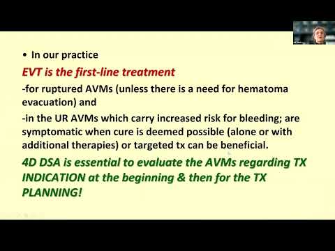 THE EANS WEBINAR: MULTIDISCIPLINARY APPROACH FOR CEREBRAL AVM’S