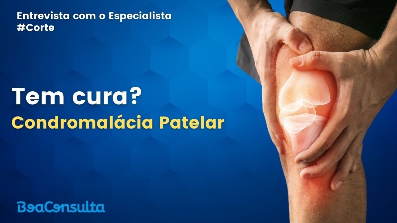 Condromalacia patelar tem cura? Especialista em joelho explica!