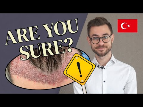 Hair Transplant in Turkey: A Warning From An Expert...