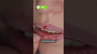 Are Your Lips Dry And Peeling? | Dr. Deepika Lunawat