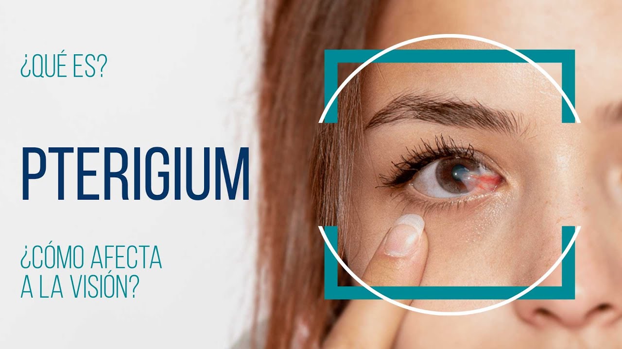 Ángel López Castro-15