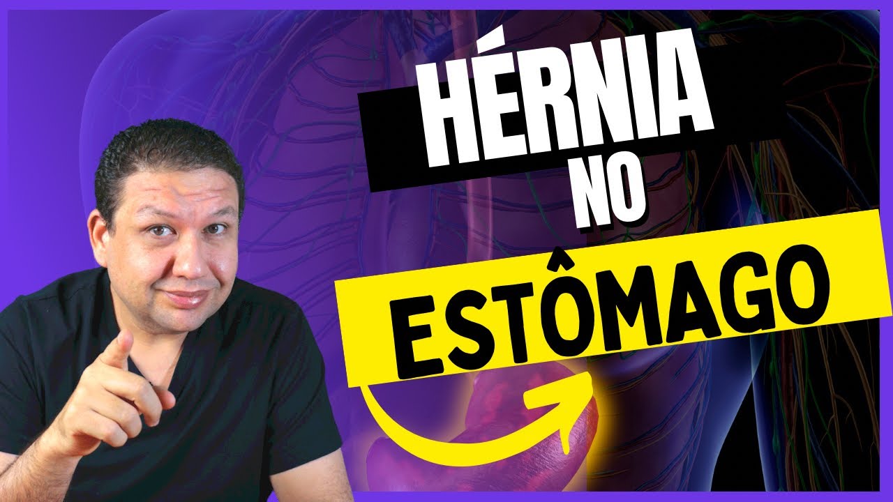 O que é uma HÉRNIA DE HIATO, hérnia do estômago que causa o refluxo.