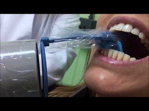 Periapical Radiograph with Positioners - Anterior Mandible