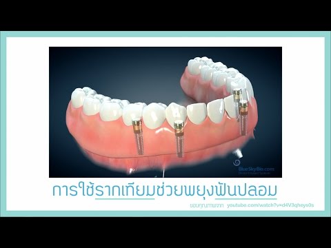 ปมด้อยหน้าอกเล็กที่ซับซ้อน เป็นไปได้ที่จะให้นมลูกรากฟันเทียม