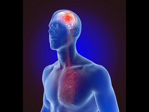 Jarosław Kosowski Prywatny Gabinet Neurologiczny - video